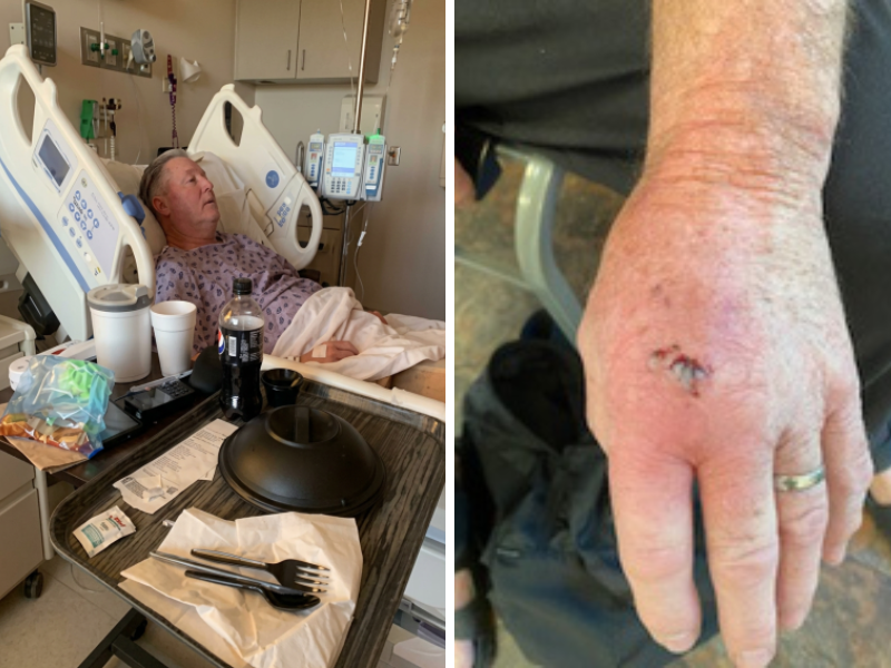 Bruce dog bite injury